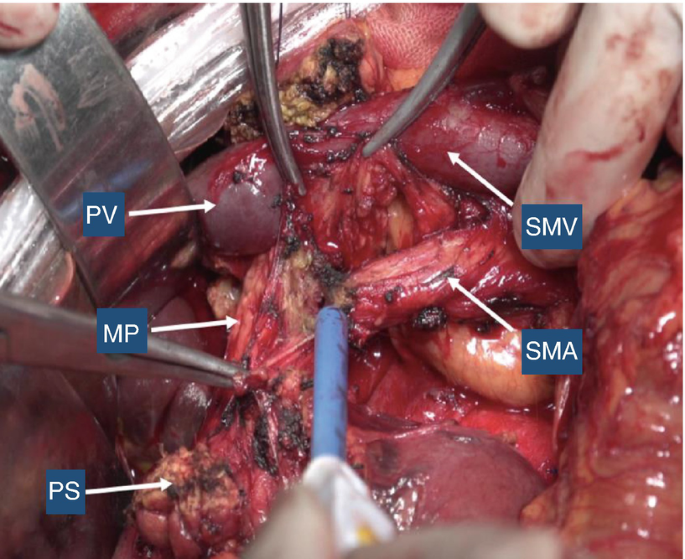 figure 27