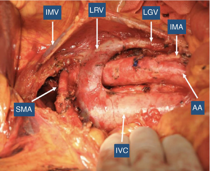 figure 31