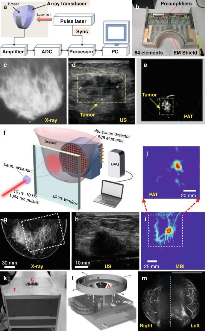 Photoacoustic Tomography Opening New Paradigms in Biomedical Imaging