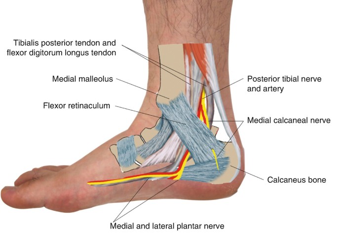 Medial Ankle Pain: Tarsal Tunnel Syndrome