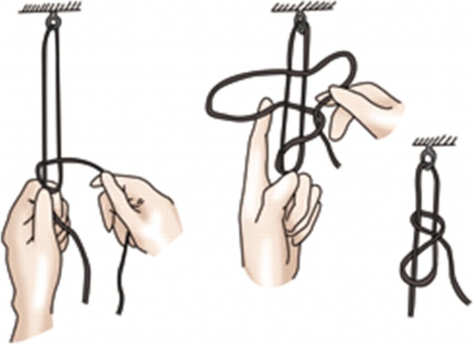 Advanced Knotting Techniques (Examples from Surgical Practice