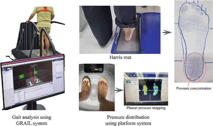 Clinical Evaluation and Prescription of Insoles | Springer Nature Link