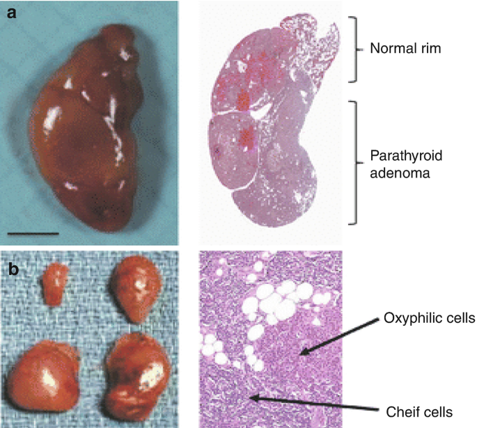 A 39-Year-Old Male With Vomiting, Diarrhea, and Abdominal Pain ...