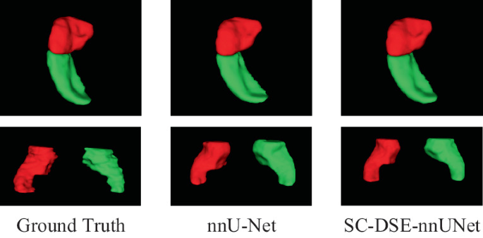 SC-DSE-nnUNet: An Efficient Hippocampus MRI Segmentation Method ...