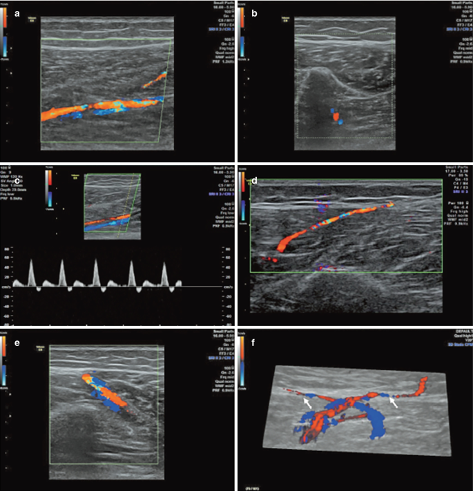 Technical Deep Dive: Doppler Shift Calculation and Signal Processing