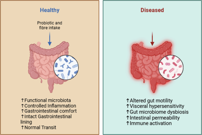 Therapeutic Role of Probiotics and Prebiotics in Irritable Bowel ...