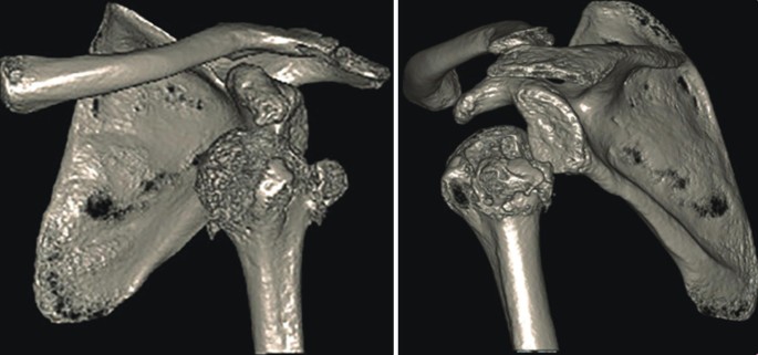 Experience and Lessons Learned from Missed Diagnosis of Anterior ...