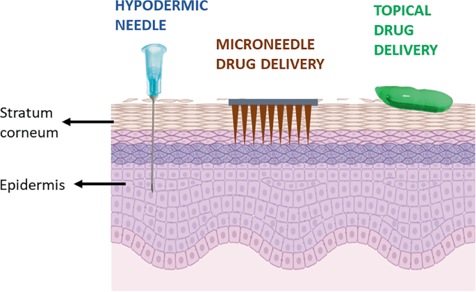Microneedles as Carriers: A Futuristics Delivery System for Medicines ...