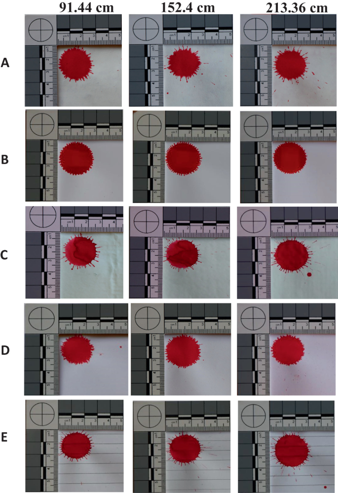 Ri Staining Pattern A Comparative Study of Bloodstain Pattern Analysis on Different Types ...