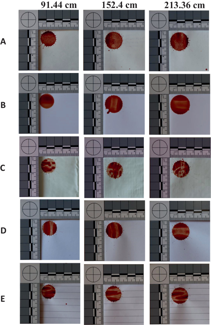 A Comparative Study of Bloodstain Pattern Analysis on Different Types ...