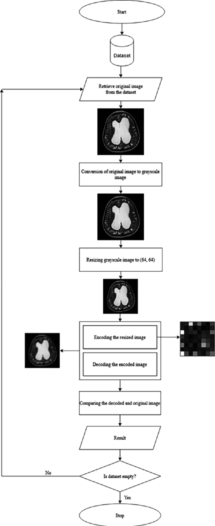 A Modified Auto-encoder Decoder-Based Approach for the Lossy Compression  and Decompression of the Hydrocephalus MRI/CT/X-Ray Images | Springer  Nature Link (formerly SpringerLink)