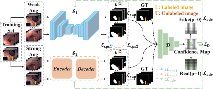 Enhancing Semi-supervised Medical Image Segmentation with Asymmetric ...