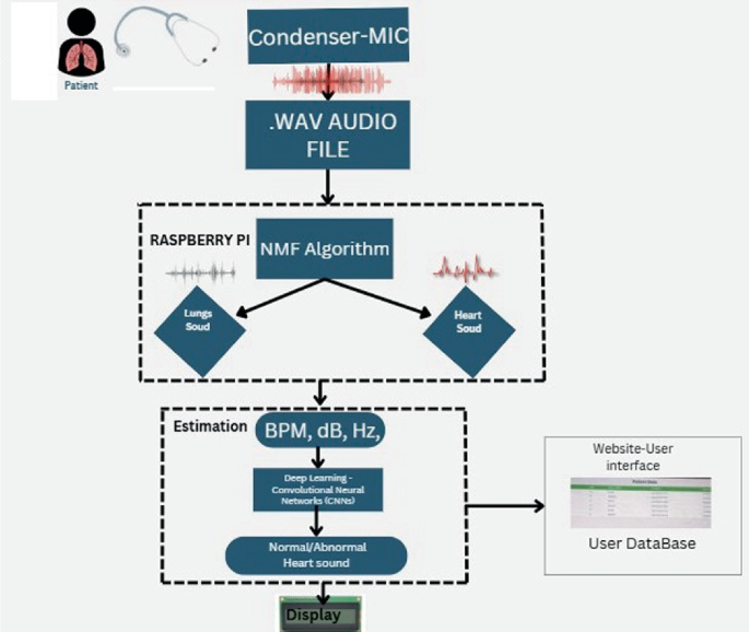 AI-Powered Digital Stethoscope for Telemedicine Applications | Springer ...