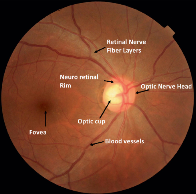 Fundus Image Classification—A Comparison of GAN-Based Image ...