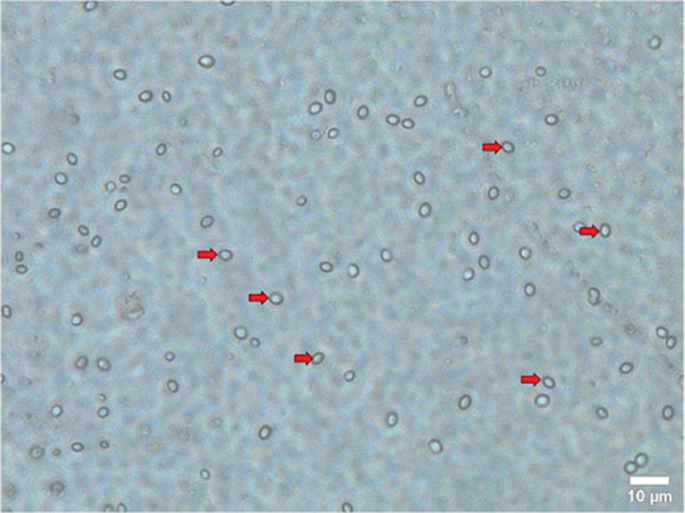 Effects of Various Environmental Conditions on the Stability of Single ...