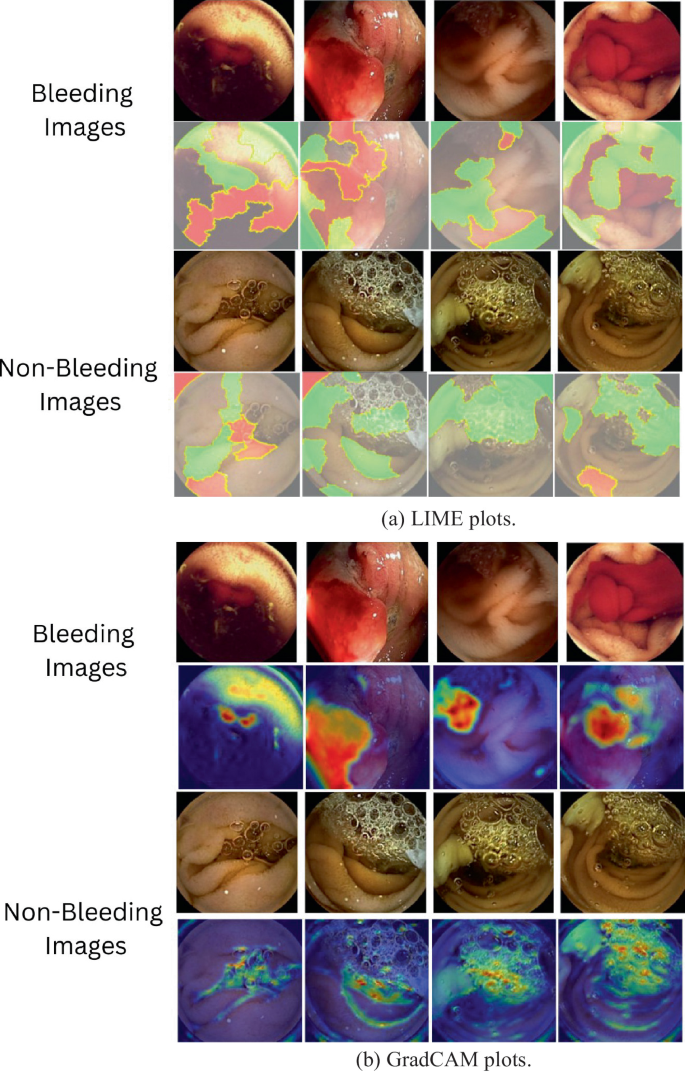 An Integrated Framework for Classifying and Locating Bleeding Areas in ...