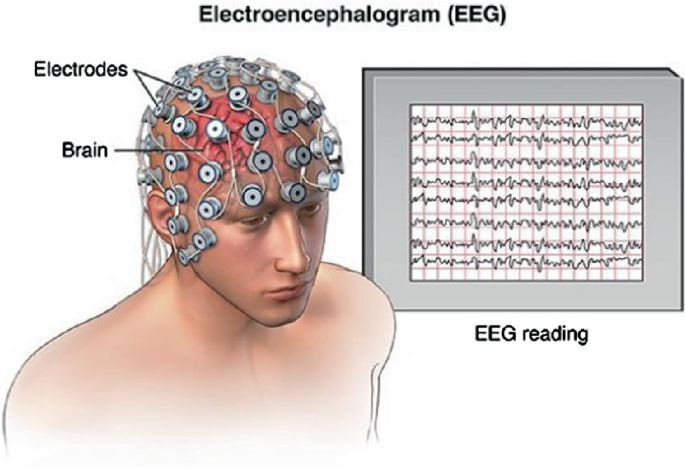 Identifying Epilepsy with Artificial Intelligence: An EEG Signal ...