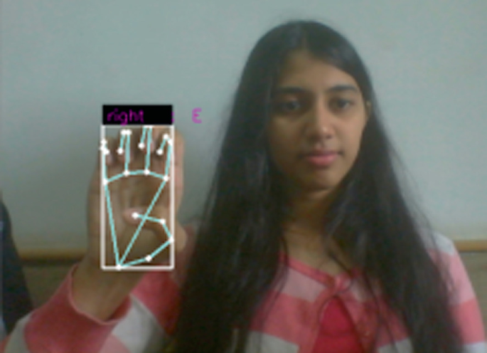 A snapshot of a woman showing her hands to make the letter E. Her hands are marked with the hand rule.