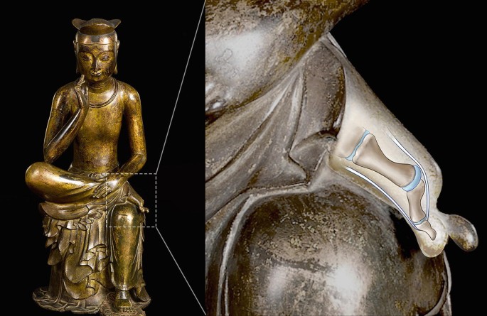 2 photos. On the left is a golden statue, with the figure sitting with one leg resting on the other. On the right is an enlarged photo of the statue with the hip joint highlighted.