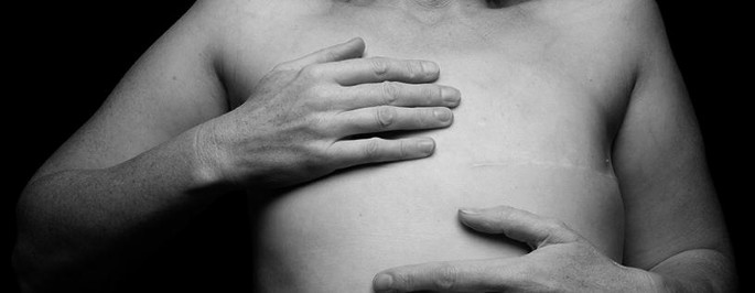 A photograph of a bare torso with no breasts and the person's one hand placed on the chest and the other on the belly.
