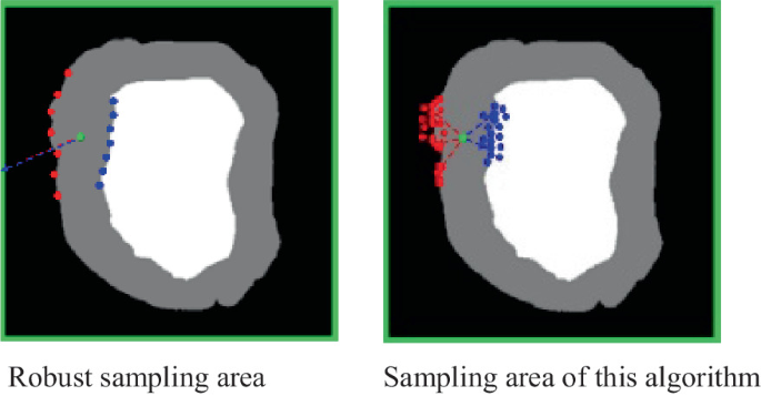A Novel Image Segmentation Method Based on Random Walk Combined with ...