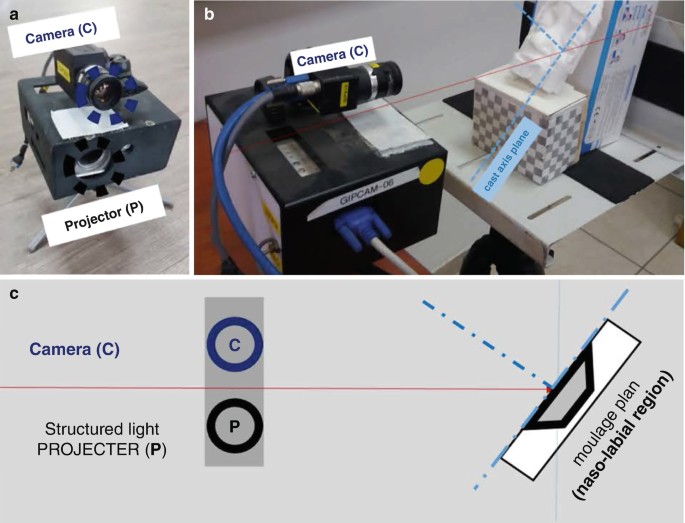 Noninvasive 3D Facial Scanning SpringerLink