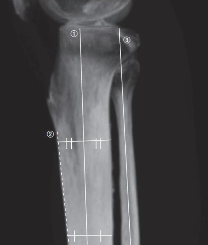 Sagittal Alignment | SpringerLink