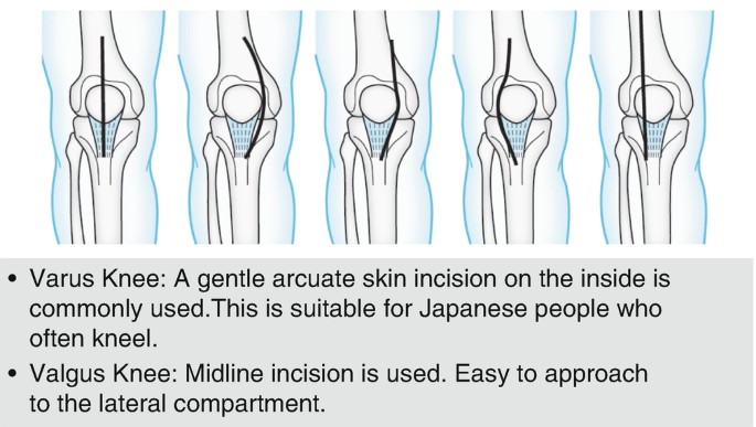 Important Aspects of Surgical Techniques | SpringerLink