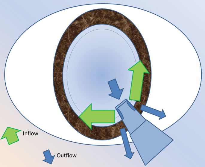 Fundamentals of Phaco Innovations: Definitions and Basic Understanding ...