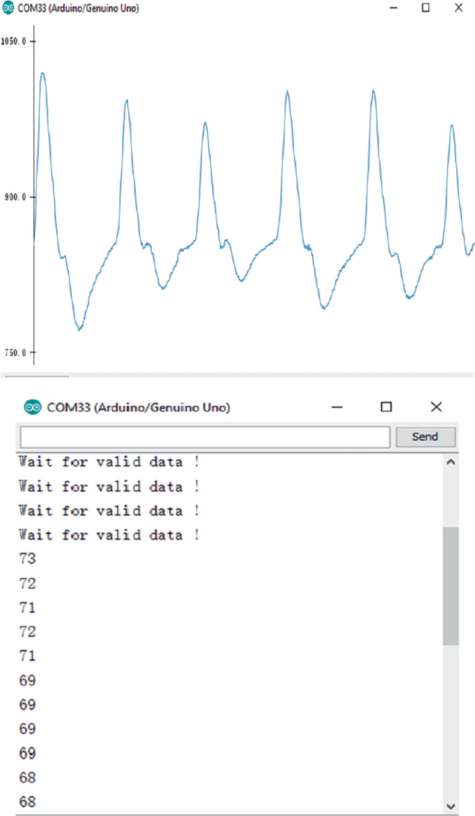 A Novel Heart Disease Monitoring and Prediction Using Machine Learning