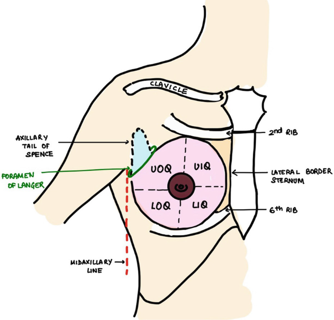 Left Rbeast Quadrants Anatomy of the Breast | SpringerLink