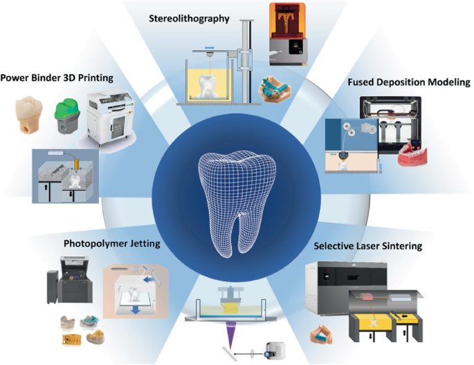 Precision Smiles: The Impact of 3D Printing in Modern Dentistry ...
