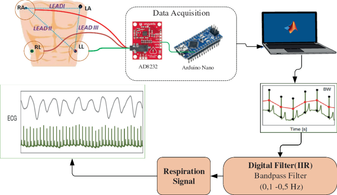 An illustration. Leads 1, 2, and 3 are connected to the data acquisition of A D 8232 and Arduino nano which is connected to the laptop, further connected to the digital filter, and respiration signal, and ends with E C G.