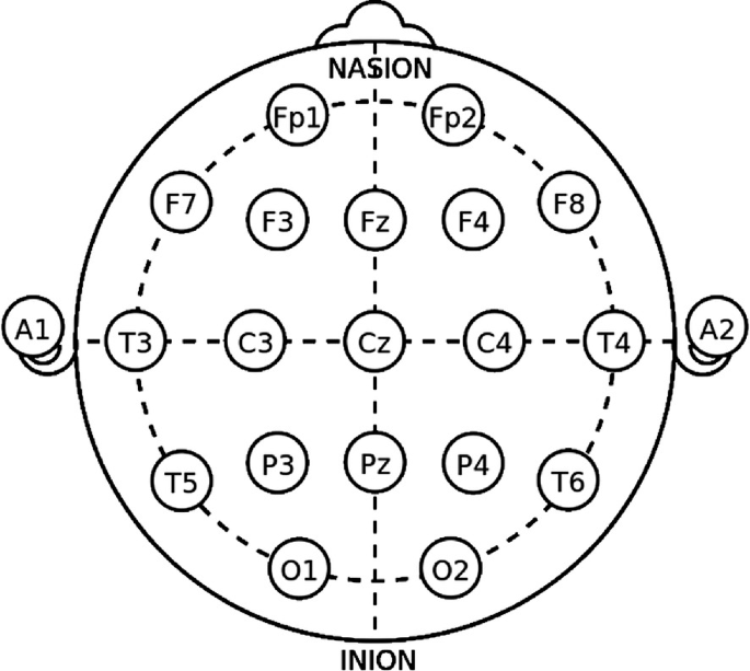 An illustration. It has a circle within which 21 electrode points are marked. A concentric circle with elements F p z, F 8, T 4, T 6, O 2, O 1, T 5, T 3, F 7, and F p 1 arranged clockwise, appears within this circle. A 1 and A 2 are 2 elements outside the circle at 2 ends of the central horizontal axis. Other elements in the same axis, from left to right are T 3, C 3, C z, C 4, and T 4. Between the central axis and the concentric circle, F 3, F Z, and F 4, are in the upper half and P 3, Pz, and P 4 are in the lower half.