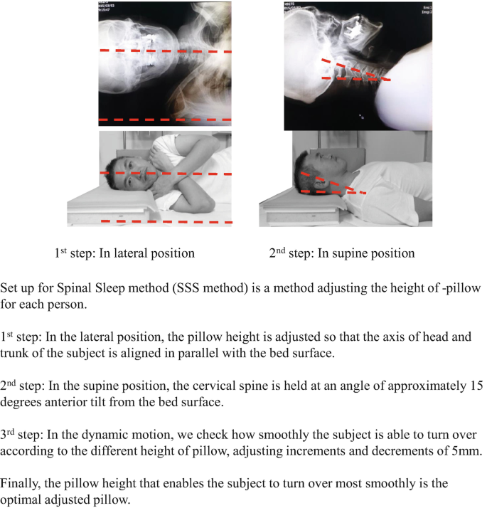 https://media.springernature.com/lw685/springer-static/image/chp%3A10.1007%2F978-981-99-0463-1_5/MediaObjects/495228_1_En_5_Fig1_HTML.png