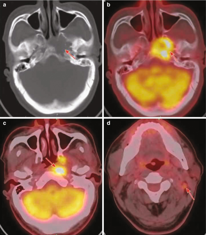 Four scanned images of the skull and mouth are labeled from A to D. An arrow indicates a noticeably dark-shaded area in A and a brightly shaded section in B to D on the center-right.