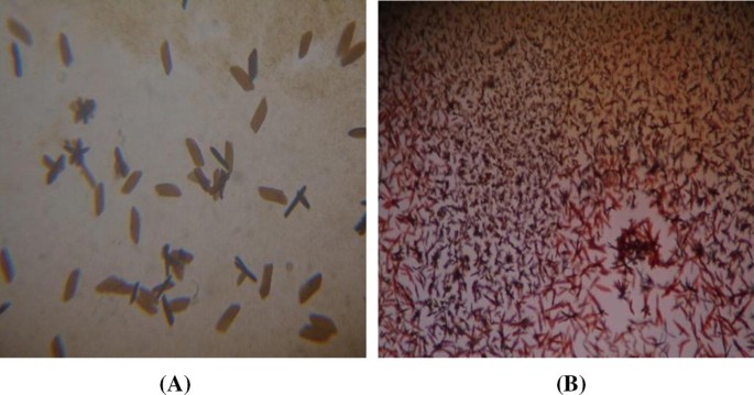 2 microscopic histological images. Image 1 consists of dark-stained spindle-shaped fragments that are loosely aggregated. Image 2 consists of dark-stained- spindle-shaped fragments that are densely aggregated.