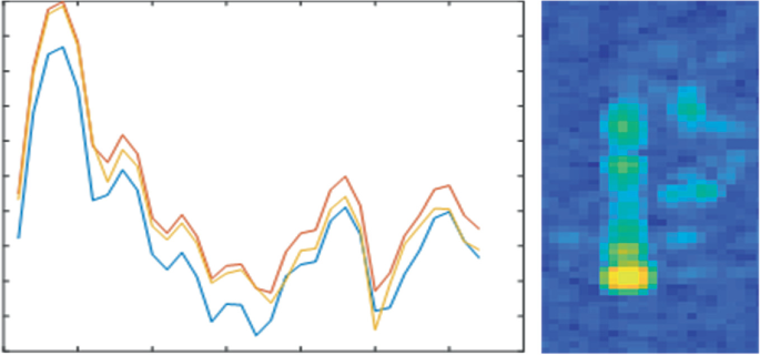 Day 19 : Chessboard using Matplotlib in Python ~ Computer