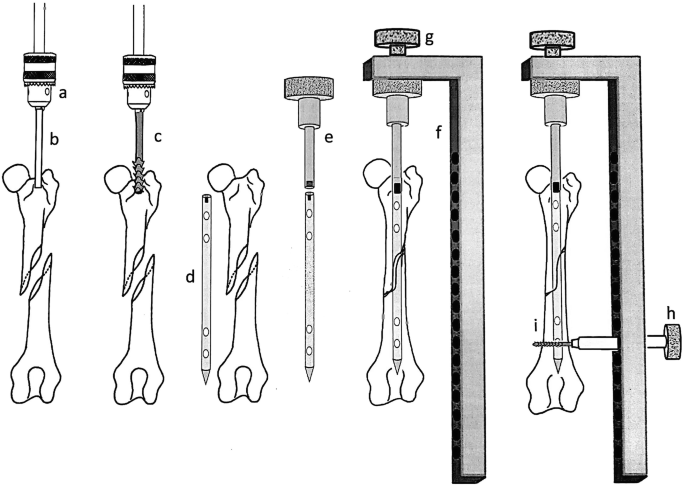 Thin shaft-rings from cattle-size tibia and metatarsus diaphyses.