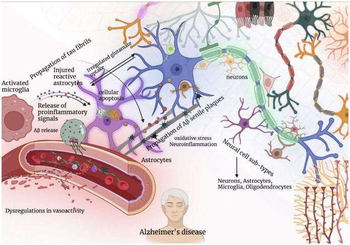 An illustration of Alzheimer’s disease with neuropathological implications. The labeled details include activated microglia, injured reactive astrocytes, the release of proinflammatory signals, dysregulations in vasoactivity, and cellular apoptosis.
