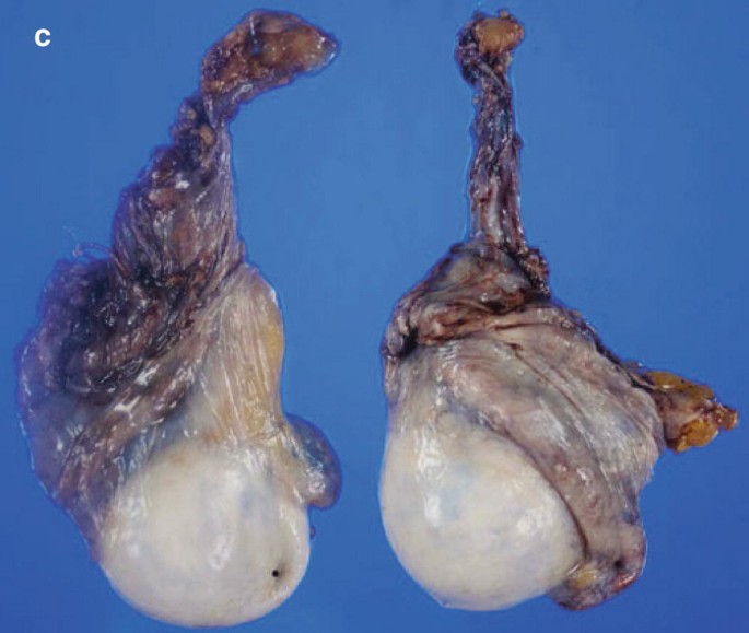 Scrotum | Springer Nature Link
