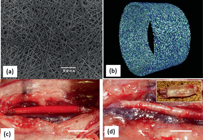 4 illustrations. A. S E M image of the P U graft exhibits the long thin tubes arranged in a nested pattern. B. 3-D micro–C T image of the P U vascular graft indicates the cylindrical and electro-spun. C and D. 2 intra-operative photos with an inset photo of the implanted P U graft with and without blood stains.