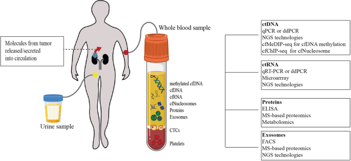 Biomarkers in Renal Cell Carcinoma | Springer Nature Link
