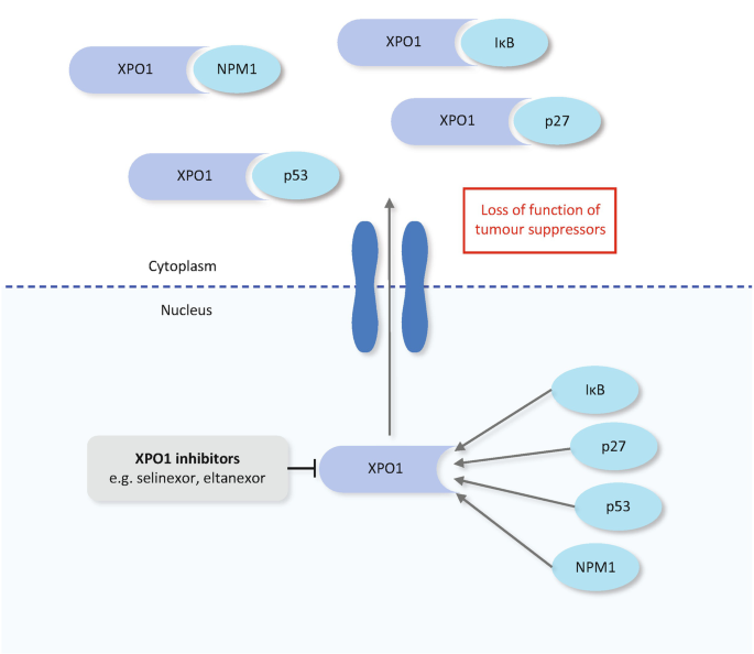 A schematic illustration of exportin 1, a nuclear exporter, contributes to A M L pathogenesis by shutting down tumor suppressors like N P M 1 and p 53 into the cytoplasm, disrupting their functions.