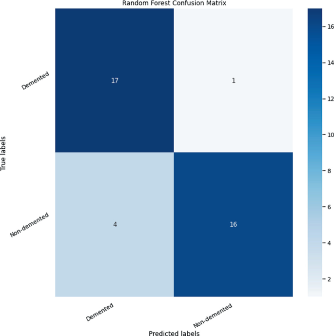 A 2 by 2 confusion matrix of true versus predicted labels in gradient shades. True and predicted demented is at 17, true and predicted non-demented is at 16, true non-demented and predicted demented is at 4, and true demented and predicted non-demented is at 1.