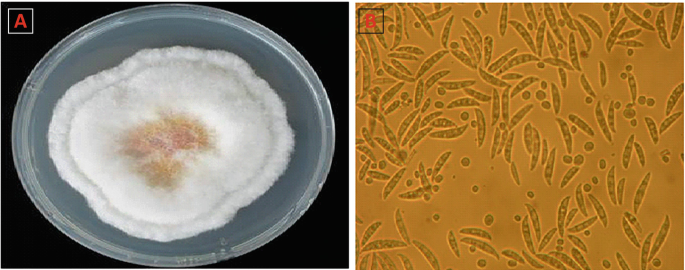 a. A photograph of the well-grown colony of Fusarium oxysporum. b. A microscopic image of Fusarium oxysporum reveals the pod-shaped particle at varying sizes.