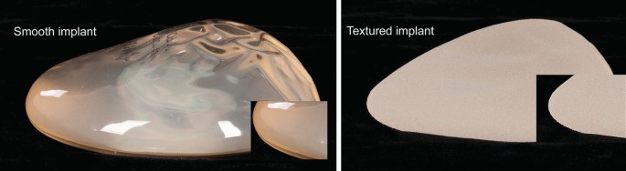 Textured vs Smooth Implants