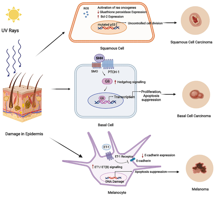glutathione melanoma and Schematic pathways showing how can account for covariations Role of Glutathione in Cancer:  Metabolic insights into tumor lymph