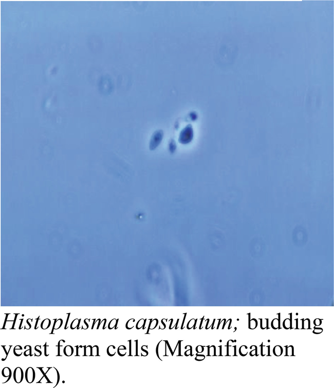 role-of-dimorphic-fungi-in-cns-infections-springerlink