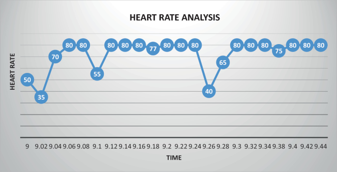 A line graph, titled heart rate analysis, of heart rate versus time. It plots a line with a constant trend and dips with the respective readings. The dips are recorded at 9.02, 9.1, and 9.26 on the x-axis. All values are estimated.